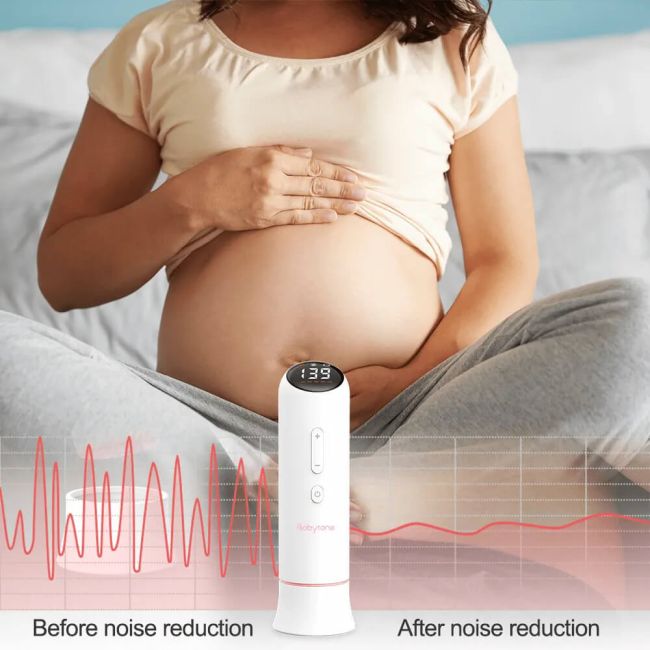 Dispozitiv Doppler, fetal smart, pentru a monitoriza bataile inimiii fatului DFRDPP01