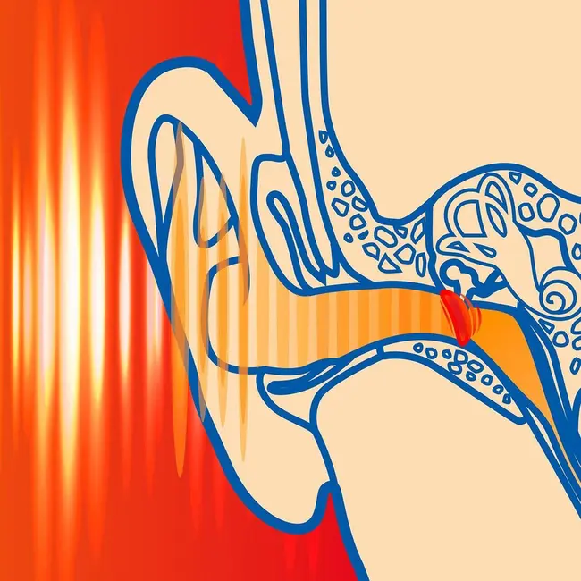 Dopuri de urechi pentru adulti, pentru protectia auzului impotriva zgomotului, SNR 37dB, 12 bucati, spuma, verde, SANOHRA Max